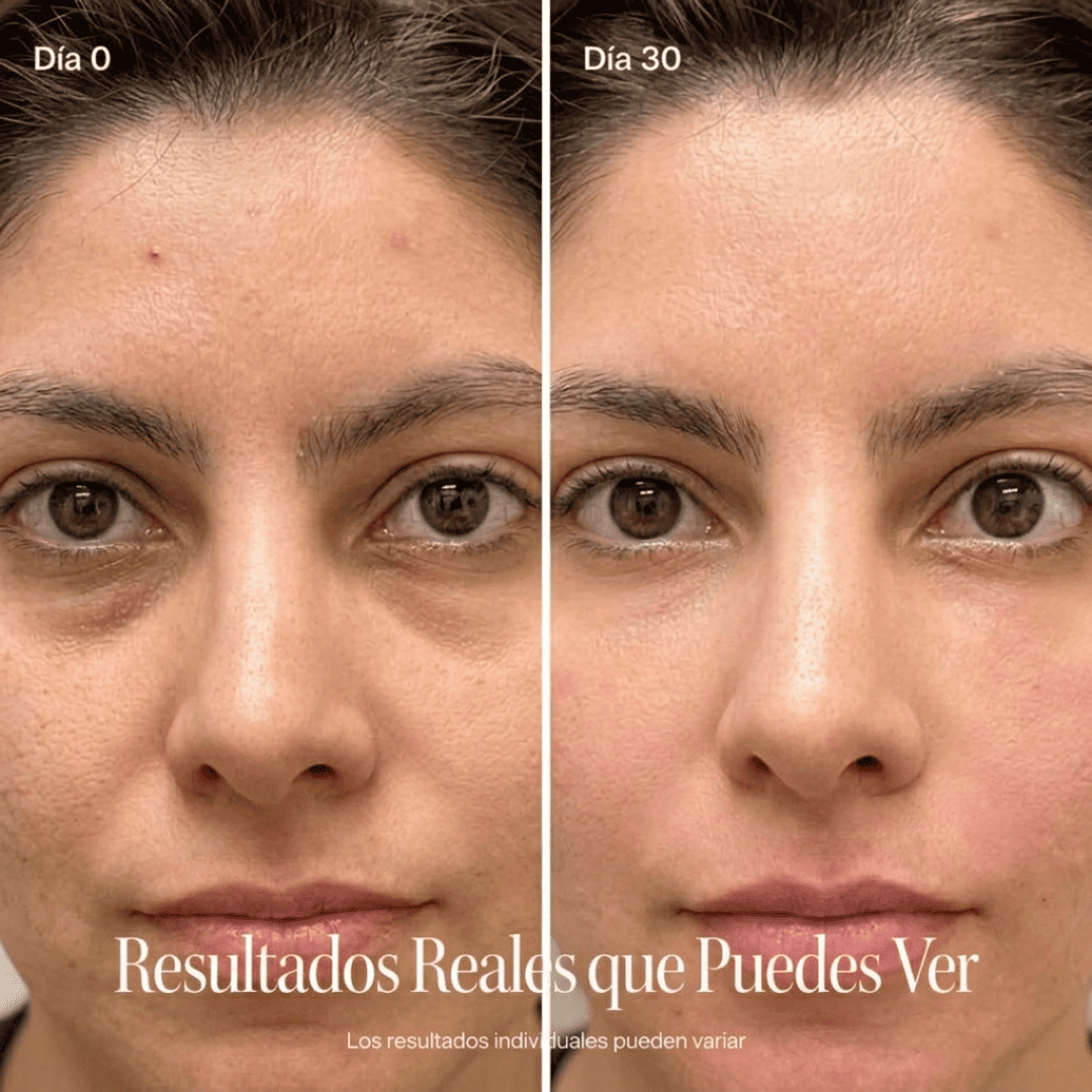 SENSUM Anti Ojeras Pro