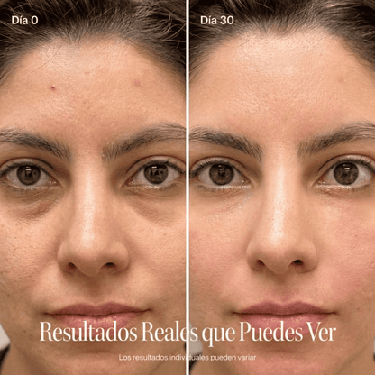 SENSUM Anti Ojeras Pro