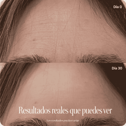 Mascara Facial Antiarrugas Pro LED