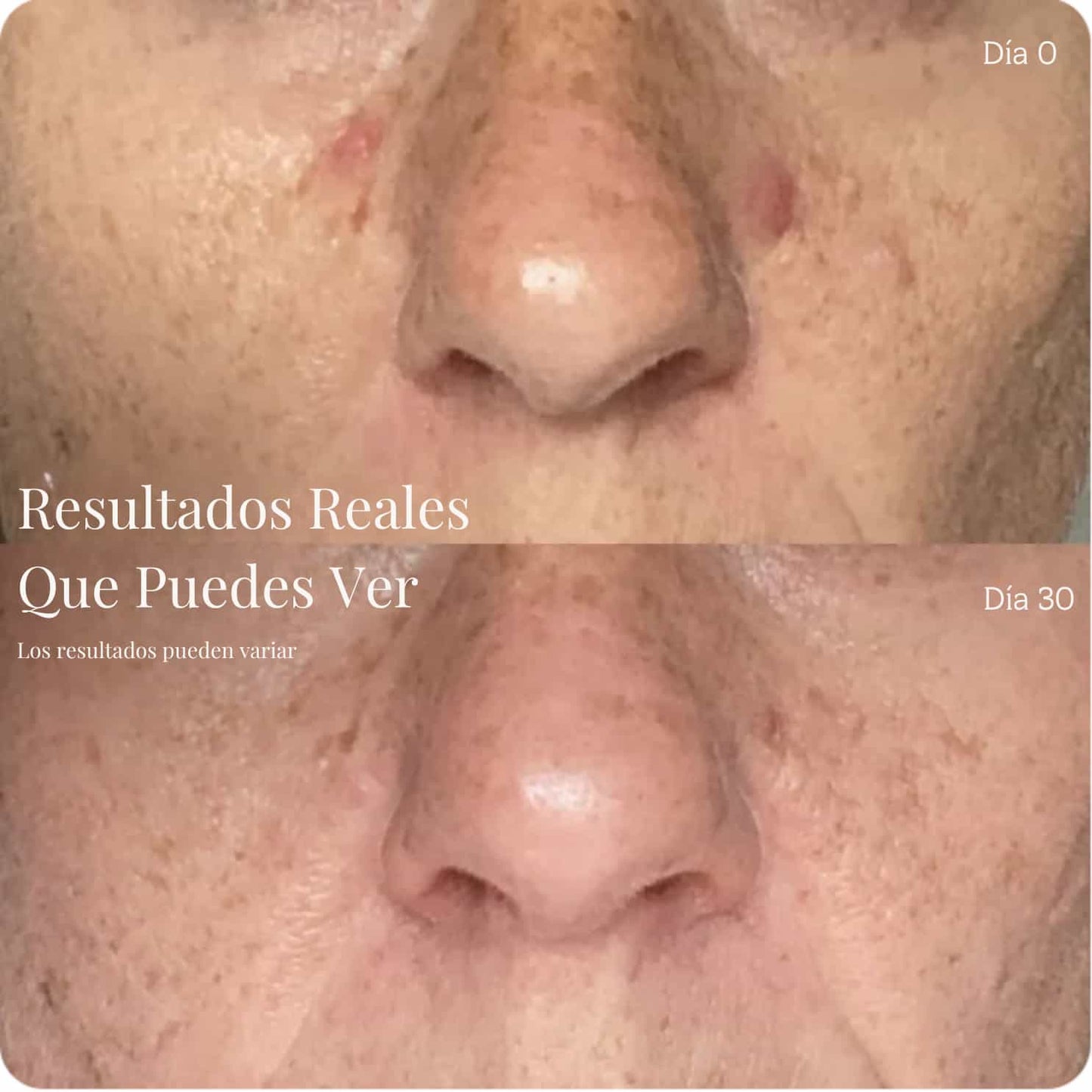 Mascara Facial Antiarrugas Pro LED