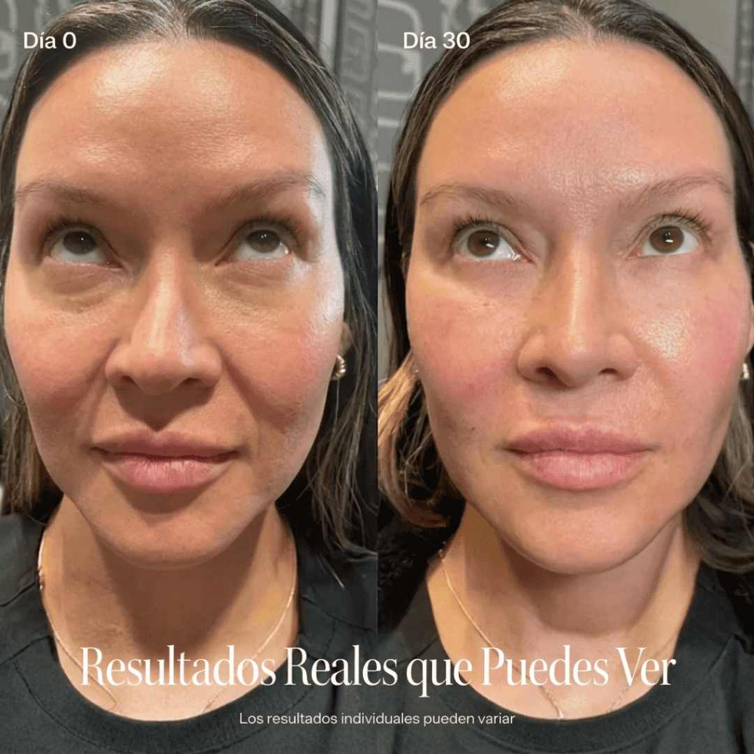 SENSUM Anti Ojeras Pro